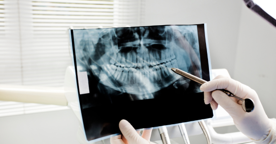 Why Getting Oral Surgery Isn’t as Frightening as You Might Imagine