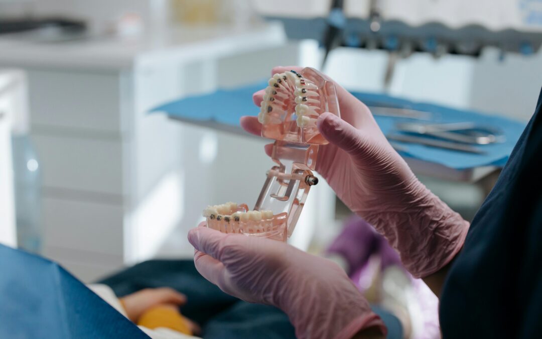 Why Winter Is a Smart Time to Schedule Oral Surgery